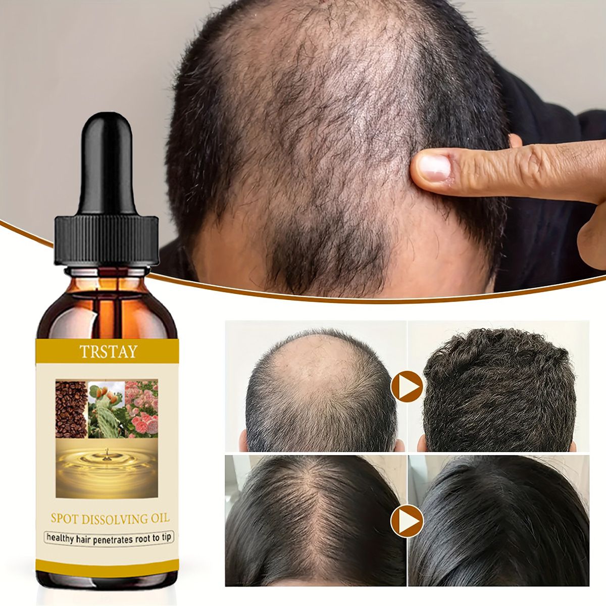 Beard Oil - 50Ml Baard Groei Olie Anti Alopecia