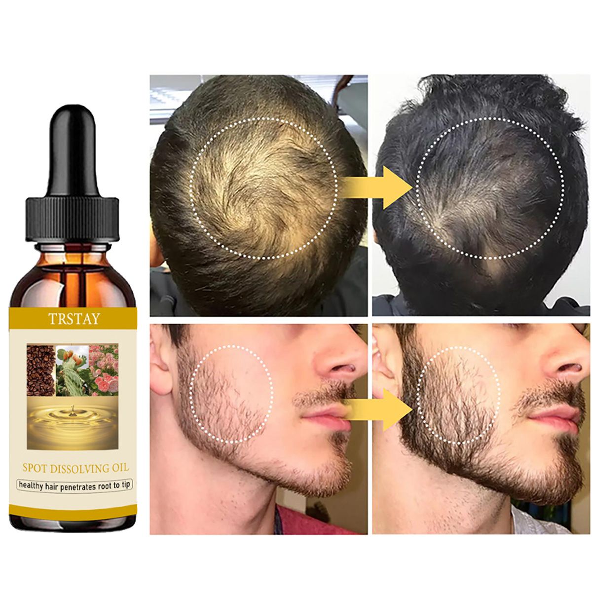 50Ml Baard Groei Olie Anti Alo - Beard Oil recensie en prijs